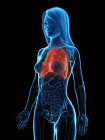 Хворобливі легені в прозорому жіночому тілі на чорному тлі.. — стокове фото