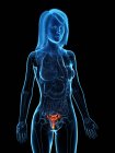 L'utérus malade dans le corps féminin, illustration numérique . — Photo de stock