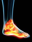 Inflamed ligaments in human foot, conceptual computer illustration. — Stock Photo