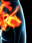 Inflamed ligaments in human hips, conceptual computer illustration. — Stock Photo