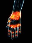 Ligamentos inflamados en la mano humana, ilustración conceptual por ordenador . - foto de stock