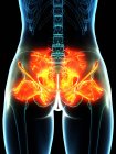 Ligaments enflammés dans les hanches humaines, illustration conceptuelle par ordinateur — Photo de stock