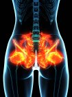 Ligaments enflammés dans les hanches humaines, illustration conceptuelle par ordinateur — Photo de stock