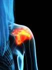 Inflamed ligaments in female shoulder, conceptual computer illustration. — Stock Photo