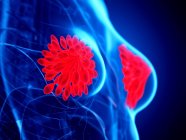 Red colored mammary glands in female abstract body on blue background, digital illustration. — Stock Photo