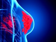 Glándulas mamarias de color rojo en el cuerpo abstracto femenino sobre fondo azul, ilustración digital . - foto de stock