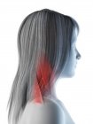 Músculos del cuello en el cuerpo femenino, vista lateral, ilustración por computadora - foto de stock