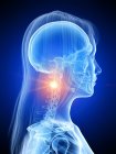 Silhouette of woman with glowing neck pain, conceptual computer illustration. — Stock Photo