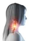 Silhouette de femme avec douleur au cou éclatante, illustration conceptuelle de l'ordinateur . — Photo de stock