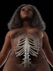 Ribcage of woman, anatomical digital illustration. — Stock Photo