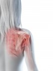 Muscles d'épaule, os et articulations du corps féminin, illustration par ordinateur — Photo de stock