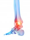 Acute pain in ankle of human foot, digital illustration. — Stock Photo