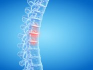 Людський хребет, що показує біль у спині, концептуальна комп'ютерна ілюстрація . — стокове фото