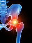 Anatomie humaine de la douleur à la hanche, illustration conceptuelle par ordinateur . — Photo de stock
