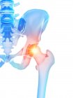 Anatomía humana del dolor de cadera, ilustración conceptual por computadora . - foto de stock
