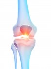 Anatomía humana del dolor de rodilla, ilustración conceptual por computadora . - foto de stock
