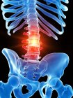 Human skeleton with lumbar pain, conceptual computer illustration. — Stock Photo