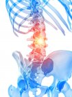 Menschliches Skelett mit Lendenschmerzen, konzeptionelle Computerillustration. — Stockfoto