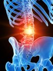 Menschliches Skelett mit Lendenschmerzen, konzeptionelle Computerillustration. — Stockfoto