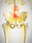 Human skeleton hips with pelvic pain, conceptual computer illustration. — Stock Photo