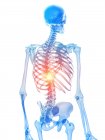Людський скелет з болем у грудях, концептуальна комп'ютерна ілюстрація . — стокове фото