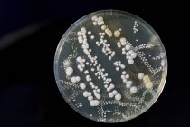 Colonias bacterianas en placas de Petri sobre fondo blanco . - foto de stock