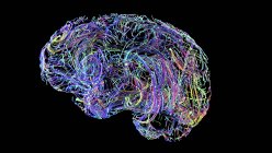 Соединения мозга, концептуальная цифровая иллюстрация . — стоковое фото