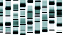 Модель авторадиографа ДНК, цифровая иллюстрация . — стоковое фото