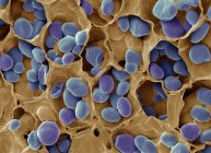 Micrographie électronique à balayage coloré des grains d'amidon dans les graines de légumineuses . — Photo de stock