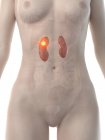 Cuerpo femenino con cáncer de riñón, ilustración conceptual por computadora . - foto de stock