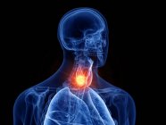 Astratto corpo maschile trasparente con cancro alla tiroide incandescente, illustrazione digitale . — Foto stock