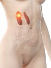 Жіноче тіло з раком нирок, концептуальна комп'ютерна ілюстрація . — стокове фото
