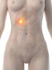 Corpo femminile con cancro alla cistifellea, illustrazione digitale concettuale . — Foto stock