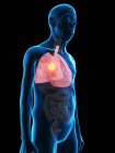 Illustrazione digitale dell'anatomia dell'uomo anziano che mostra il tumore ai polmoni . — Foto stock
