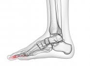Ossa di falange distali nell'illustrazione computerizzata a raggi X del piede umano . — Foto stock