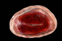 Uovo di Enterobius vermicularis threadworm contenente larva di verme, agente causale dell'enterobiasi, illustrazione al computer . — Foto stock
