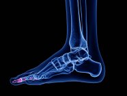 Distale Phalanxknochen in der Röntgencomputerdarstellung des menschlichen Fußes. — Stockfoto