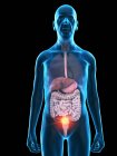 Ilustração digital da anatomia do homem sênior mostrando tumor digestivo . — Fotografia de Stock