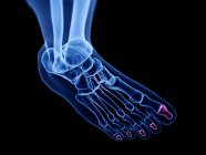 Дистальные кости фаланги в рентгеновской компьютерной иллюстрации человеческой ноги . — стоковое фото