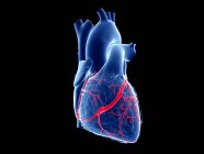 Ишемическая болезнь сердца, компьютерная иллюстрация. — стоковое фото