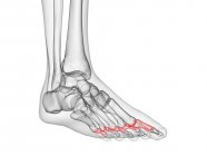 Ossa di falange prossimali nell'illustrazione computerizzata a raggi X del piede umano . — Foto stock