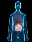 Illustrazione digitale dell'anatomia dell'uomo anziano che mostra il tumore dell'intestino tenue . — Foto stock