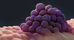 Ilustração gerada digitalmente do cluster de células cancerígenas abstratas . — Fotografia de Stock