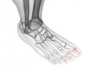 Дистальные кости фаланги в рентгеновской компьютерной иллюстрации человеческой ноги . — стоковое фото