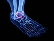 Talusknochen in der Röntgencomputerdarstellung des menschlichen Fußes. — Stockfoto