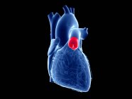 Человеческое сердце с цветным легочным клапаном, компьютерная иллюстрация . — стоковое фото
