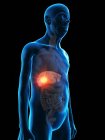 Ilustración digital de la anatomía del hombre mayor que muestra tumor hepático . - foto de stock