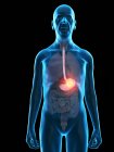 Ilustração digital da anatomia do homem sênior mostrando tumor de estômago . — Fotografia de Stock