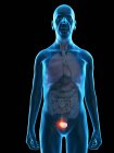 Ilustração digital da anatomia do homem sênior mostrando tumor de bexiga . — Fotografia de Stock