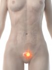 Жіноче тіло з раком сечового міхура, концептуальна комп'ютерна ілюстрація . — стокове фото